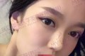 四川美萊醫(yī)學(xué)美容醫(yī)院做雙眼皮哪個醫(yī)生比較好