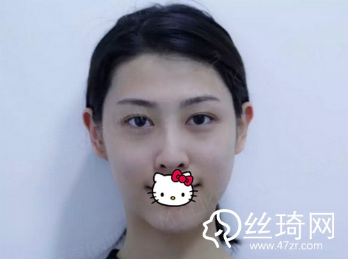 四川美萊醫(yī)學(xué)美容醫(yī)院熊猛怎么樣