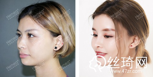 北京禾美嘉醫(yī)療美容怎么樣內(nèi)附2019全新價(jià)格表