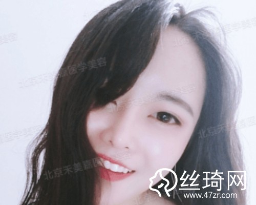 北京禾美嘉醫(yī)療美容自體脂肪填充面部那個(gè)醫(yī)生好？