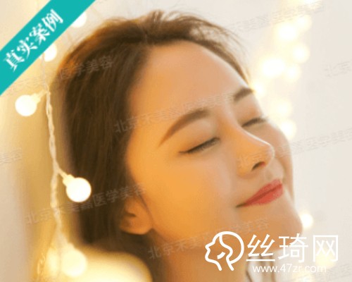 北京禾美嘉醫(yī)療美容自體脂肪填充面部那個(gè)醫(yī)生好？