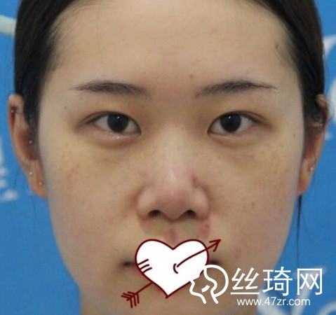 成都恒博醫(yī)院李烈醫(yī)生怎么樣？