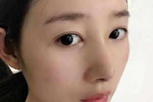 成都雙下巴吸脂多少錢 成都吸脂價格貴不貴