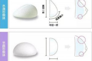 隆胸假體那么多，我們應該如何選擇呢?