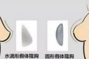 關(guān)于隆胸你較關(guān)心的幾個問題