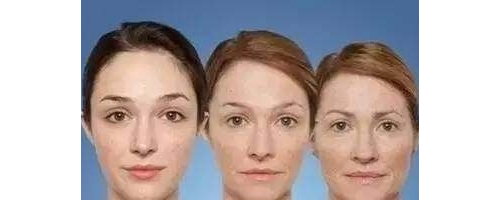 面部年輕化，多方面進入時代