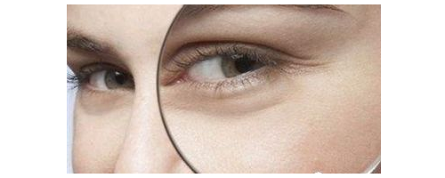 去魚尾紋要多少錢，去魚尾紋價格貴不貴