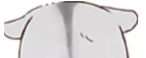 顴骨寬大，選擇顴弓內(nèi)推還是脂肪填充？哪個能讓臉變小