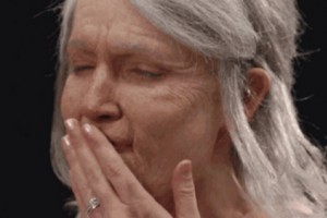 ?抗衰還得靠注射除皺!皺紋形成原因？