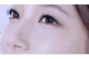 跟大家總結(jié)做雙眼皮手術(shù)要注意的7大細(xì)節(jié)