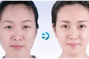 重慶鵬愛醫(yī)療美容醫(yī)院全新價格表