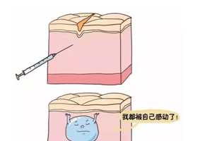 成都玻尿酸豐唇要多少錢 成都市玻尿酸豐唇價格表