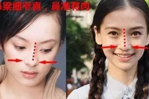 豐厚大鼻子、多肉細(xì)窄鼻子、獅子鼻、希臘鼻各是什么意思
