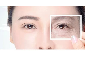 內(nèi)切去眼袋是什么 內(nèi)切去眼袋優(yōu)勢和適合人群