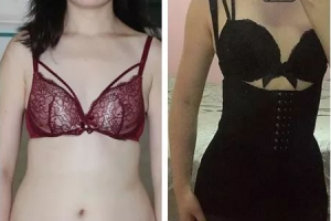 為什么吸脂減肥不容易反彈？只有肥胖者才能吸脂嗎？