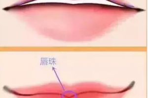 迷死人的微笑唇究竟是怎么做的？玻尿酸豐唇果好不好