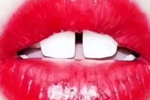 門牙縫大“漏財(cái)”還毀顏值，整形牙科醫(yī)教你2招關(guān)縫納財(cái)！