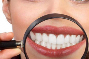 杭州美萊口腔醫(yī)院，口腔知識科普：牙齒美白多少錢一次？