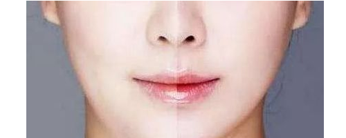 3分鐘，帶你了解醫(yī)美“黑話”