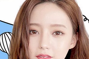 深圳割雙眼皮需要多少錢(qián)