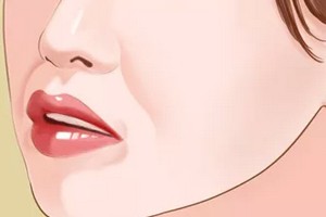 天生法令紋很深怎么辦？