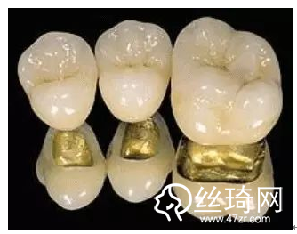 二氧化鋯全瓷冠與金屬烤瓷牙比較哪個好