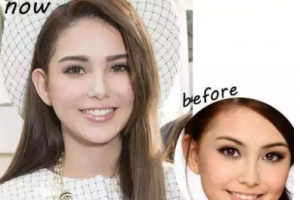 牙齒美白——擁有一口健康亮白的牙齒，笑起來(lái)才會(huì)更迷人！