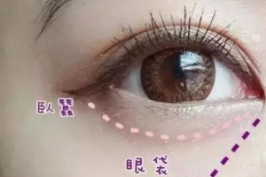 這3個(gè)溝不解決，永遠(yuǎn)顯老！