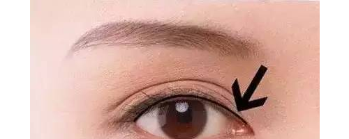 美瞳線這么美，你一定要做！