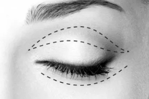 廣州曙光醫(yī)學(xué)美容醫(yī)院實(shí)力附2019年價(jià)格表