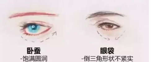 玻尿酸注射『臥蠶』，你需要嗎？