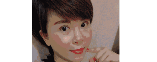 深圳藝星整形醫(yī)生常德成：她脂肪填充后，臉居然變小了？