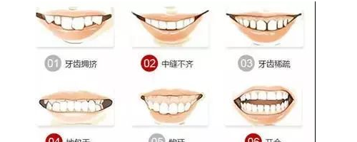 為什么牙齒矯正這么貴？