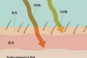 深圳藝星整形醫(yī)生王明海：為什么有些人夏天曬不黑？而你一曬就黑…