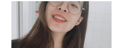 分享一些牙齒矯正的事情，希望能幫到你