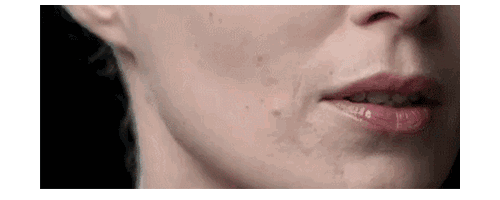 揭開埋線提升秘密，幫你留住仙氣！