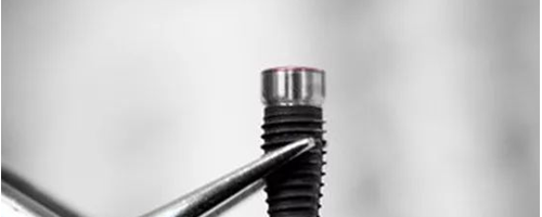 揭秘種植牙內(nèi)幕，種植牙有什么好處？真的是貴嗎？