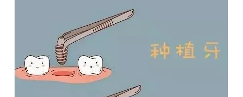 種植牙是在口腔里放一個(gè)“種子”讓牙萌出嗎？