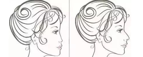 隆鼻N年后會怎么樣？需要再更換嗎？