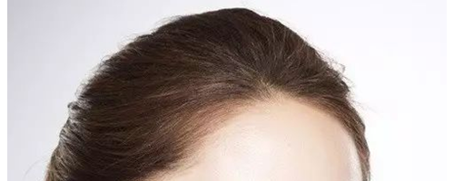 為什么祛斑越祛越多？