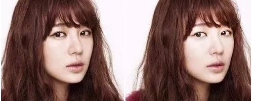 臥蠶與眼袋有什么區(qū)別？為什么臥蠶顯得可愛(ài)而眼袋會(huì)顯老呢