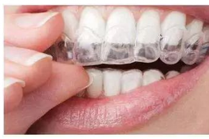 牙齒矯正后，臉會瘦嗎？臉型會產(chǎn)生哪些變化