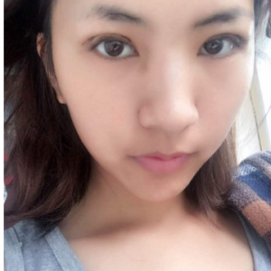 煤炭總醫(yī)院整形科整形價(jià)格表一覽及醫(yī)院整形介紹