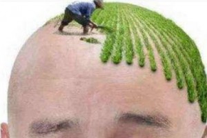 北京瑞麗詩植發(fā)怎么樣附全新價(jià)格表(價(jià)目表)