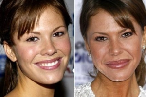 成都恒博醫(yī)院植發(fā)中心怎么樣附全新價格表(價目表)