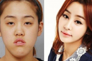 廣州倍生植發(fā)怎么樣附全新價(jià)格表(價(jià)目表)