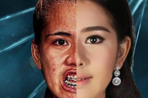 武漢科技大學(xué)附屬天佑醫(yī)院植發(fā)中心怎么樣附全新價(jià)格表(價(jià)目表)