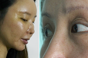 南京科發(fā)源植發(fā)怎么樣附全新價(jià)格表(價(jià)目表)