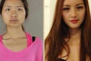 武漢美都久生生毛發(fā)移植怎么樣附全新價(jià)格表(價(jià)目表)