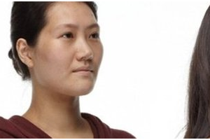 北京圣嘉新醫(yī)院植發(fā)中心怎么樣附全新價(jià)格表(價(jià)目表)